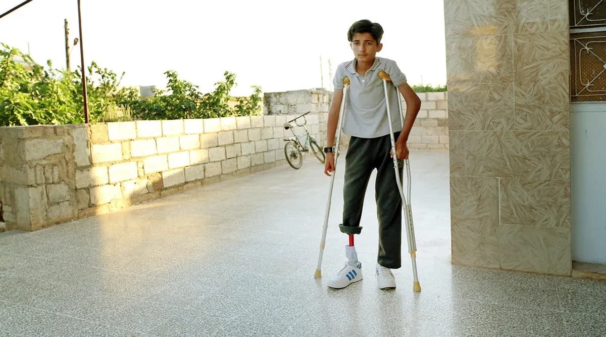 3D Printing Revolutionizes Prosthetics for Amputees in Northwest Syria